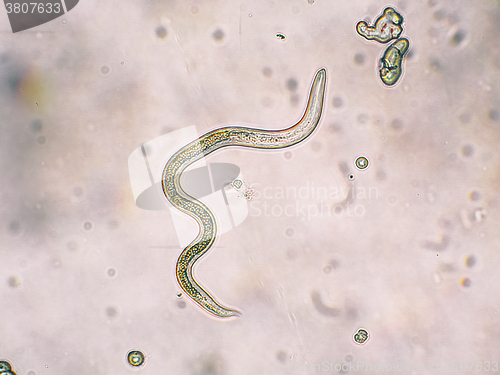 Image of Toxocara canis second stage larvae hatch from eggs