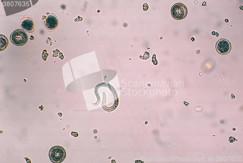 Image of Toxocara canis and embryonated egg with larva