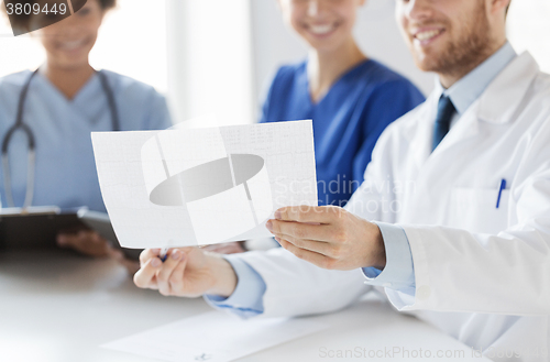 Image of close up of doctors with cardiogram at hospital 