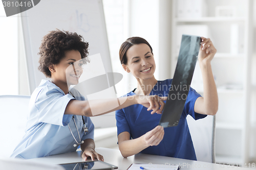 Image of happy female doctors with x-ray image at hospital