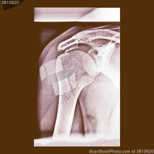 Image of  Xray vintage