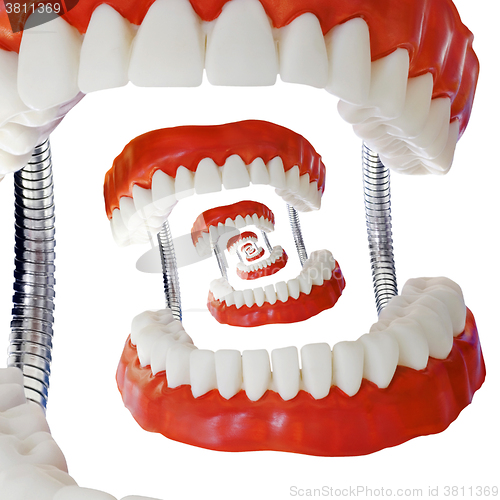 Image of Droste Denture Model Cutout