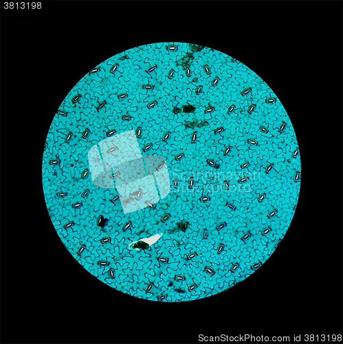 Image of Stoma micrograph