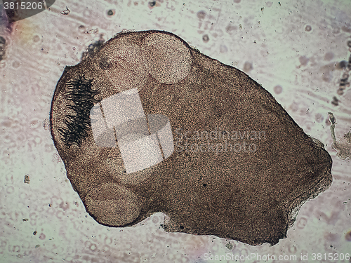 Image of Multiceps multiceps protoscoleces