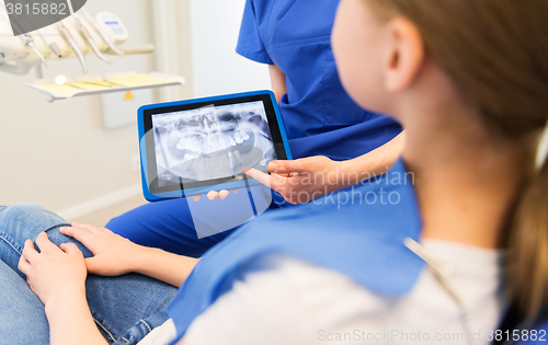 Image of dentist showing x-ray on tablet pc to patient girl