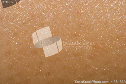 Image of Human skin pattern