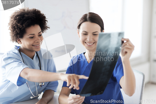 Image of happy female doctors with x-ray image at hospital