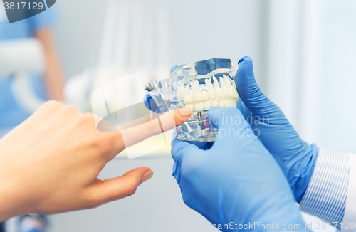 Image of close up of dentist hands with teeth or jaw model