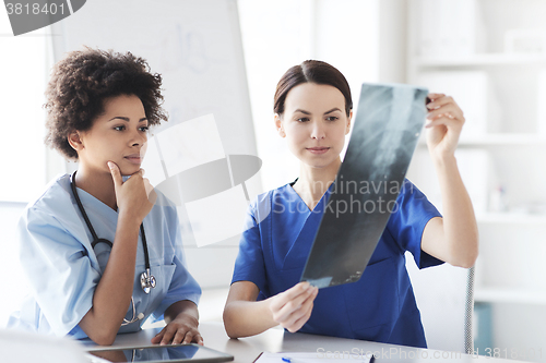 Image of female doctors with x-ray image at hospital