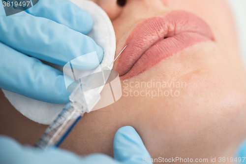 Image of woman gets injection in her lips
