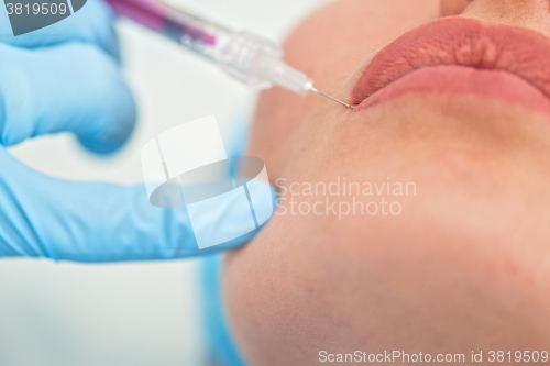 Image of woman gets injection in her lips