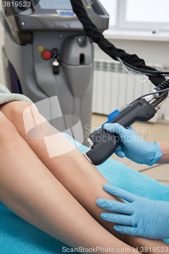 Image of laser legs epilation