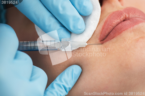 Image of woman gets injection in her lips