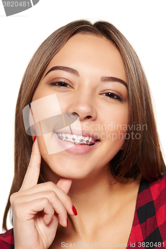 Image of Teen female smiling with braces on her teeth