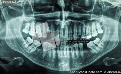 Image of Human teeth xray