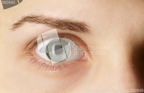 Image of open eye