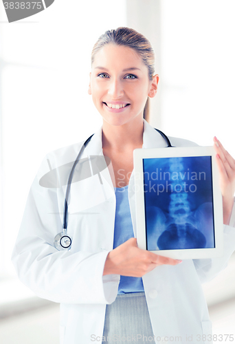 Image of female doctor with x-ray on tablet pc