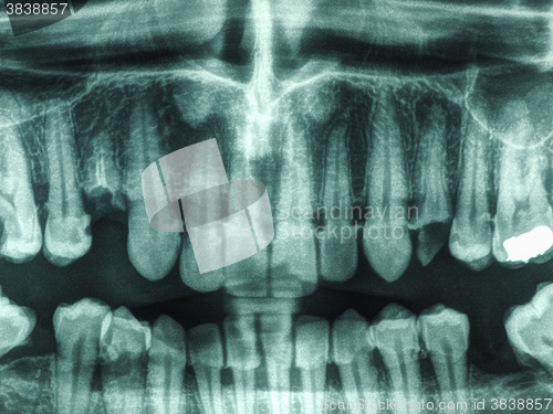 Image of Human teeth xray