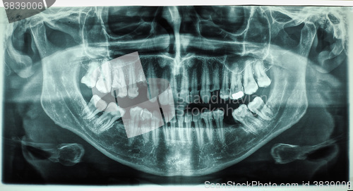 Image of Human teeth xray