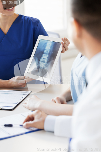 Image of close up of happy doctors with x-ray at hospital