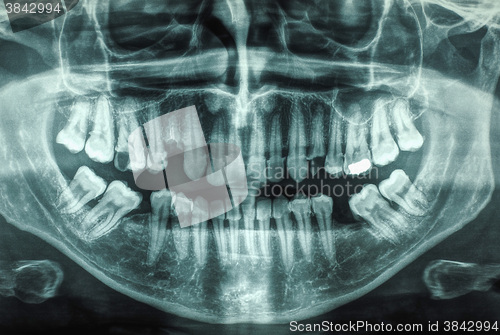 Image of Human teeth xray