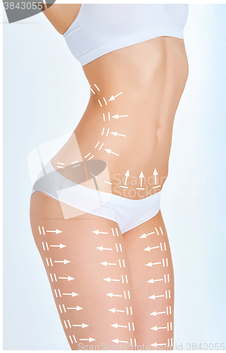 Image of The cellulite removal plan. White markings on young woman body 