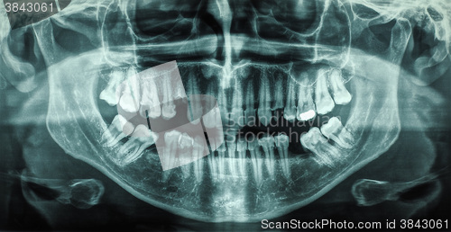 Image of Human teeth xray