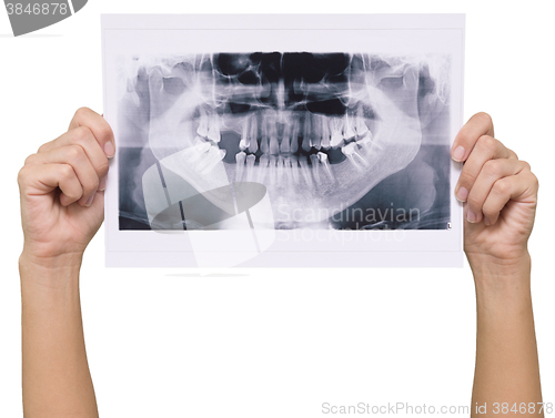 Image of panoramic x-ray skan