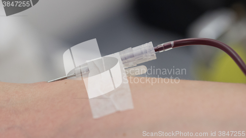 Image of Donor in an armchair donates blood,, close-up