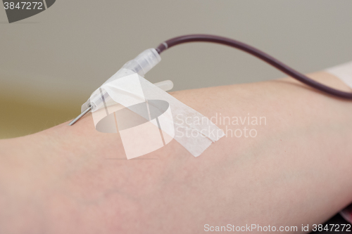 Image of Donor in an armchair donates blood,, close-up