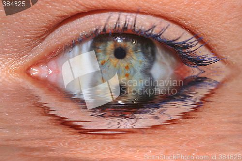 Image of Eye