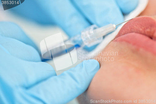 Image of woman gets injection in her lips