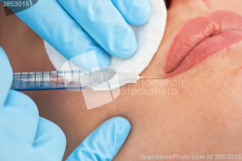 Image of woman gets injection in her lips