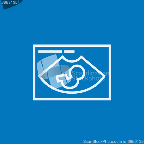 Image of Fetal ultrasound line icon.