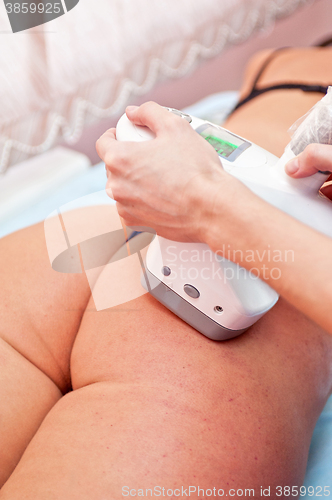 Image of procedure for women 