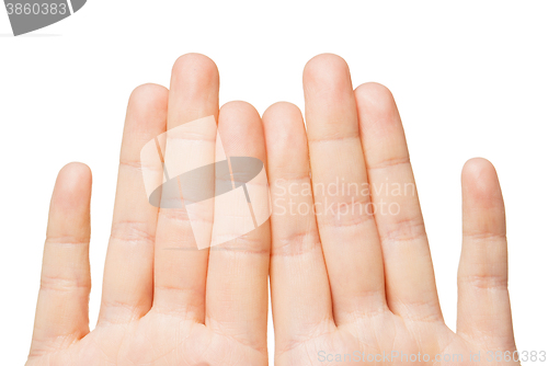 Image of close up of hands showing eight fingers