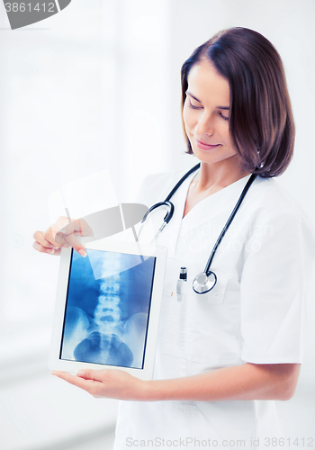 Image of female doctor with x-ray on tablet pc