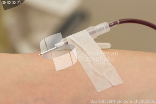 Image of Donor in an armchair donates blood,, close-up