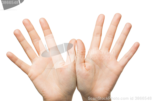 Image of close up of two hands showing palms