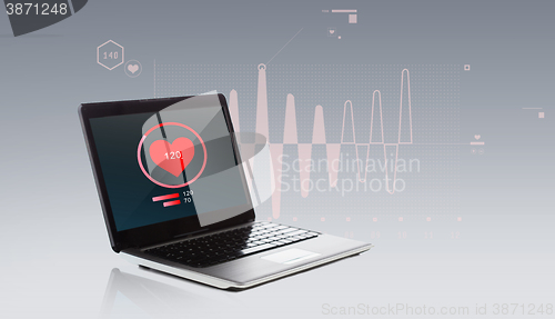 Image of laptop computer with heart beat icon