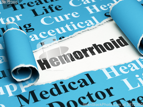 Image of Health concept: black text Hemorrhoid under the piece of  torn paper