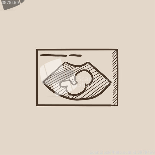 Image of Fetal ultrasound sketch icon.