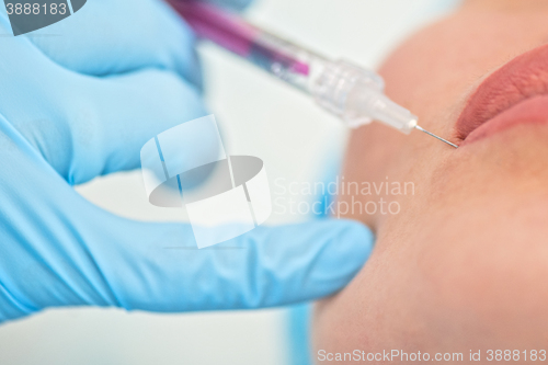 Image of woman gets injection in her lips