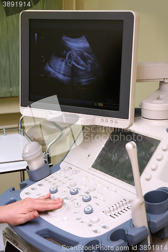 Image of medical examining pregnant belly by ultrasonic scan of a baby on