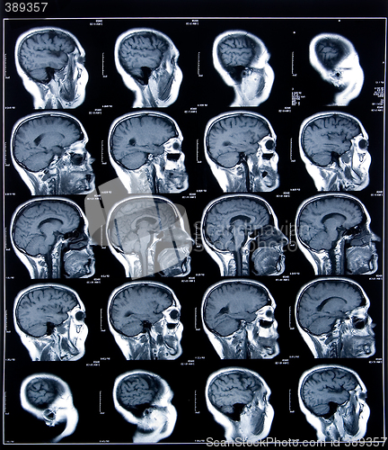 Image of health medical mri