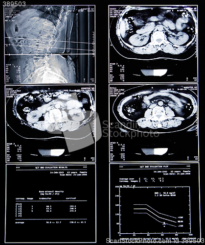 Image of health medical scan