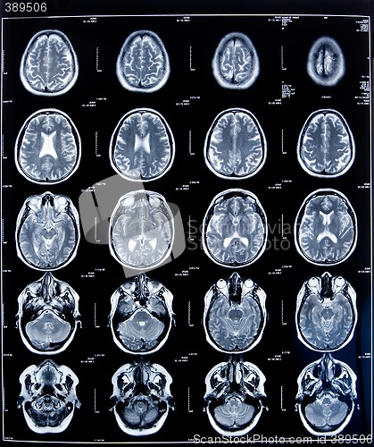 Image of health medical mri