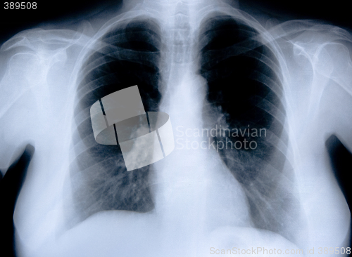 Image of health medical x ray