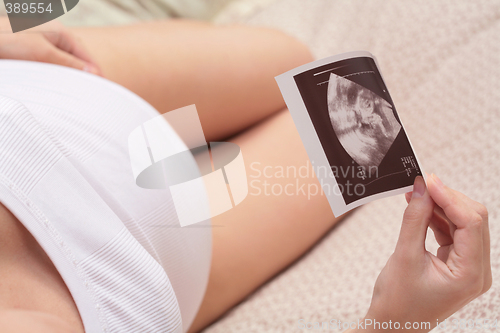 Image of pregnancy, ultrasonic portrait of the fetus