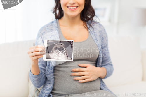 Image of close up of pregnant woman with ultrasound image